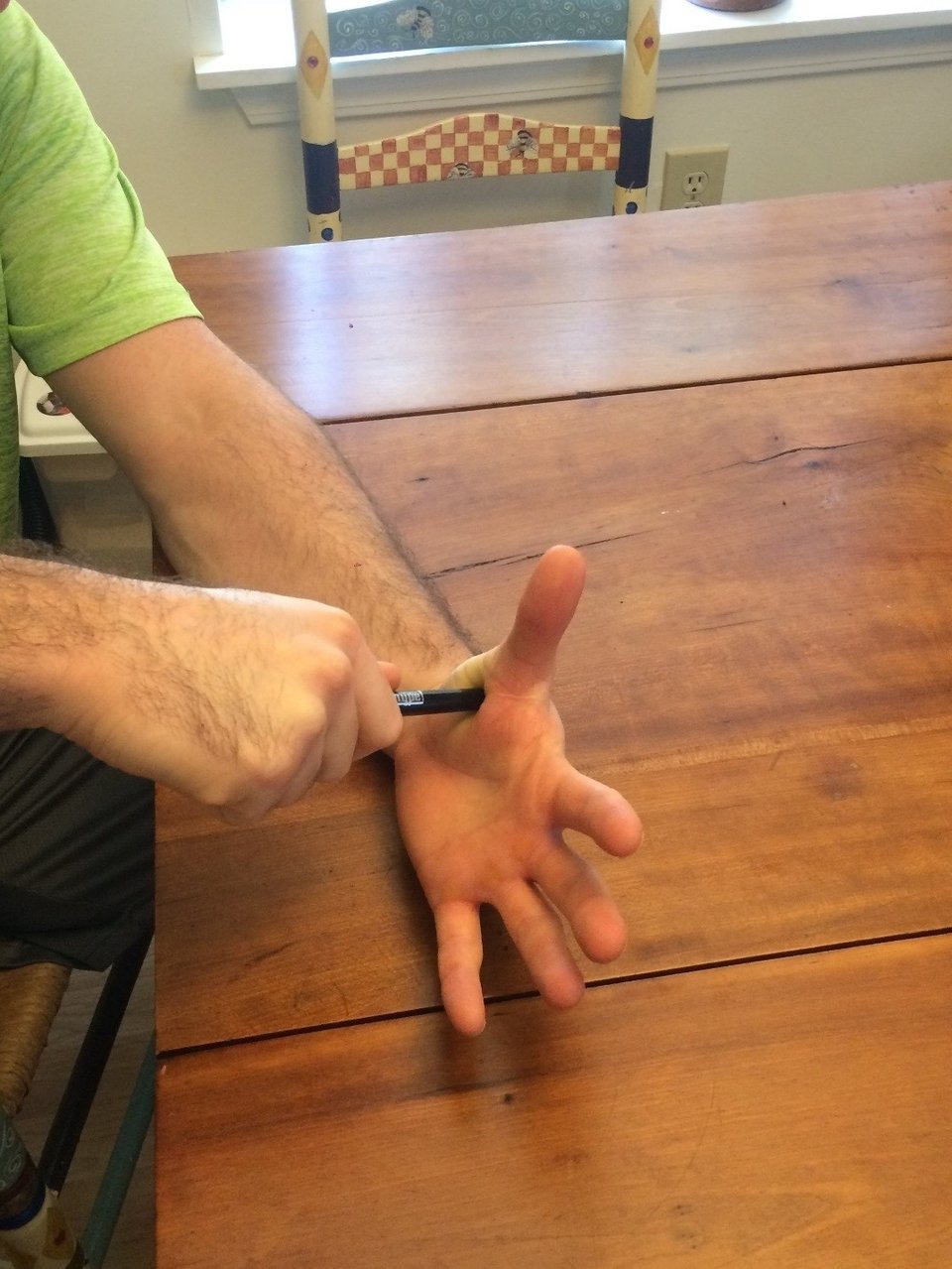 Repetitive Strain Injury And 4 Ways To Prevent It
